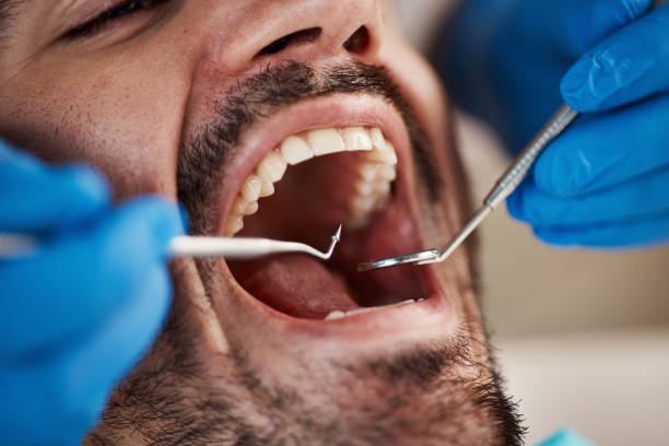 Best Emergency Treatment for Dental Infections or Abscesses in Fairland, OK