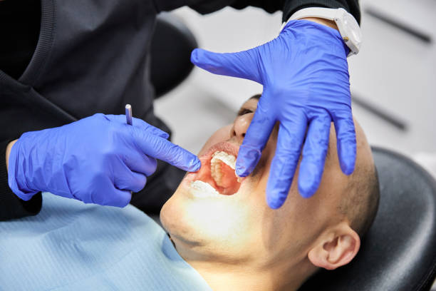 Best Emergency Treatment for Dental Infections or Abscesses in Fairland, OK
