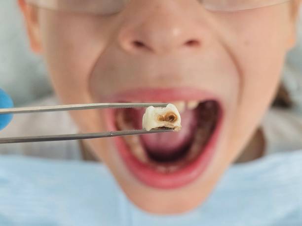Best Pediatric Emergency Dentist in Fairland, OK